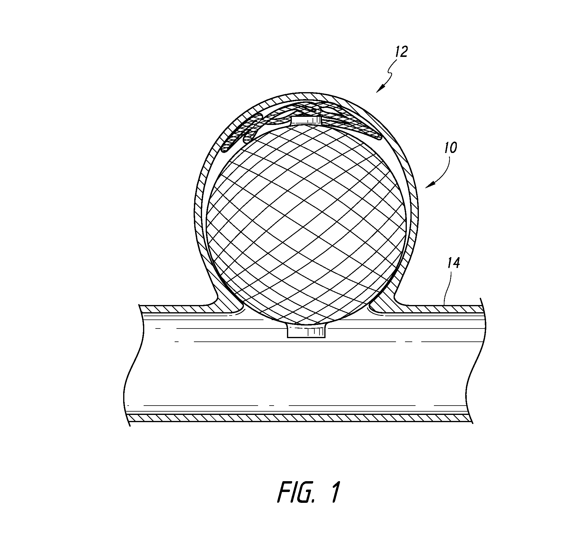 Occlusive Device