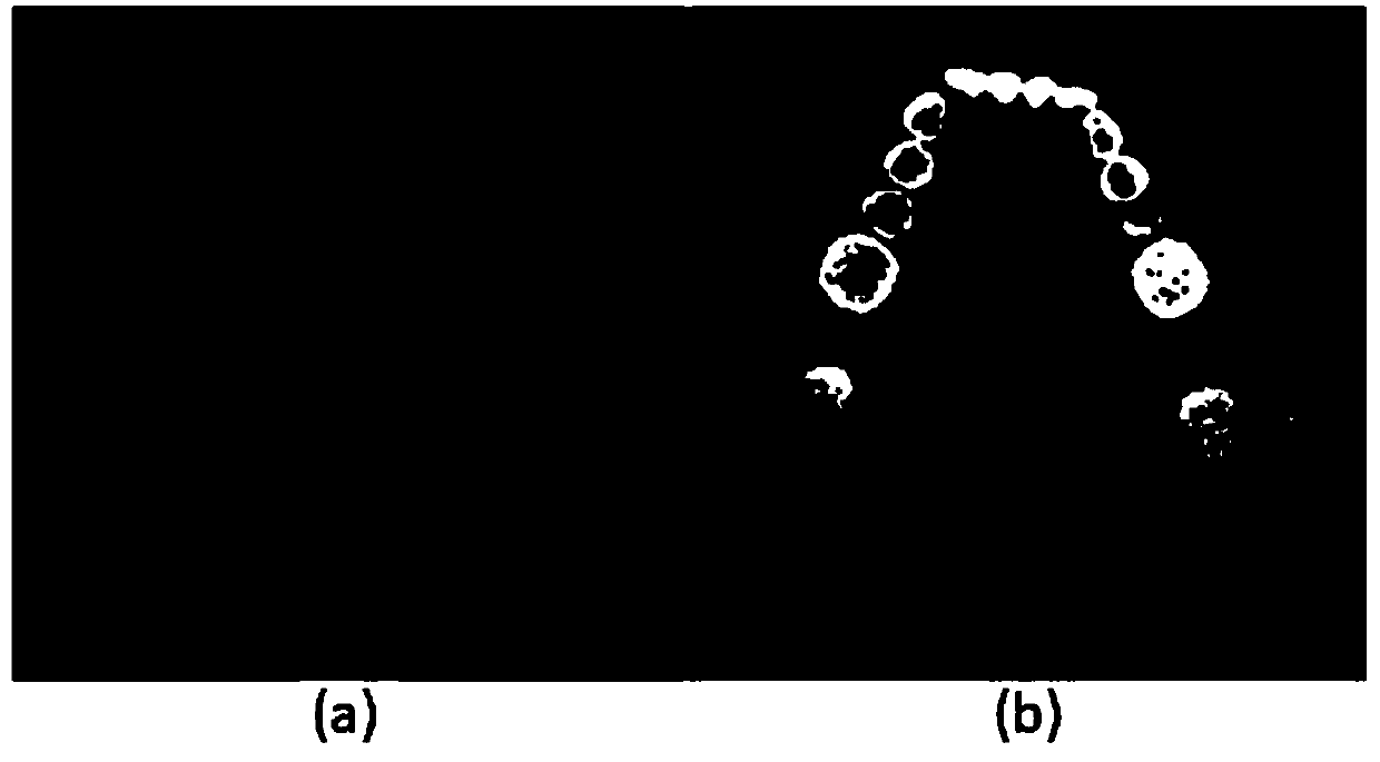 A tooth CT image segmentation method based on deep learning