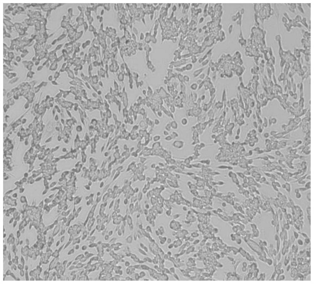 Biomarker for diagnosing ovarian cell apoptosis and injury caused by heavy metal uranium