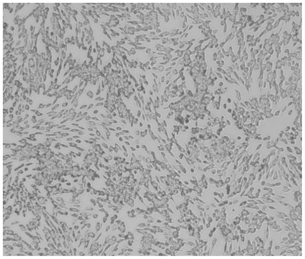 Biomarker for diagnosing ovarian cell apoptosis and injury caused by heavy metal uranium