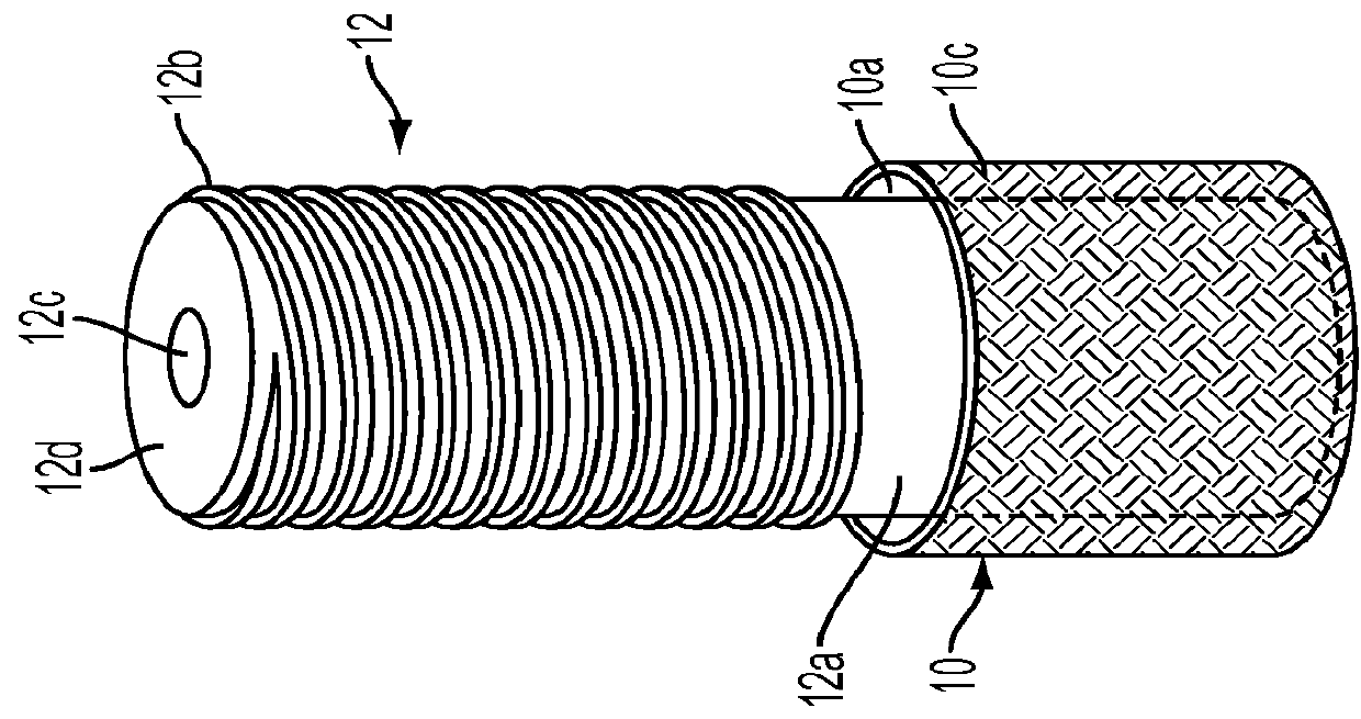 Method and apparatus to restore a tooth implant impaired by peri-implantitis