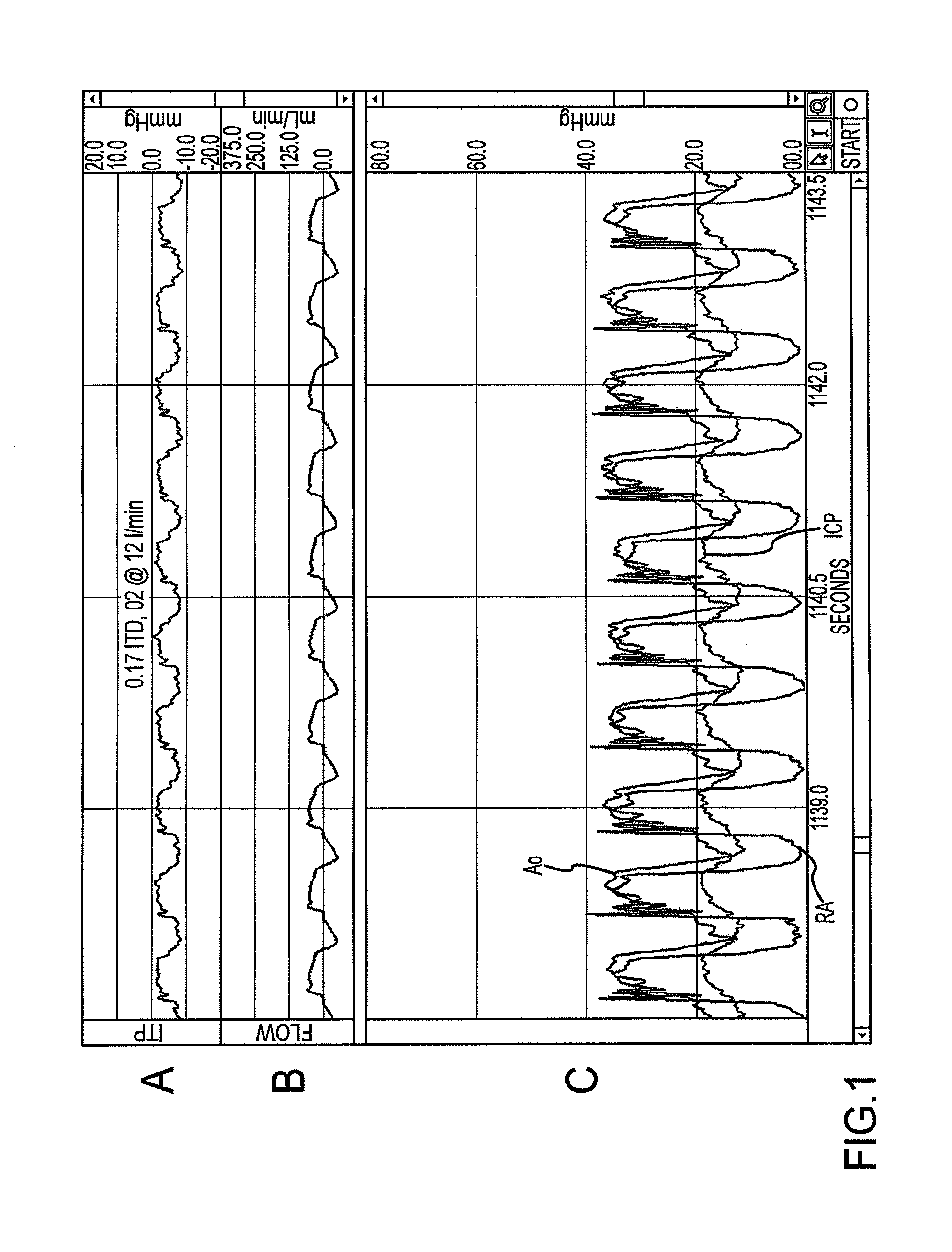 Airway adjunct resuscitation systems and methods