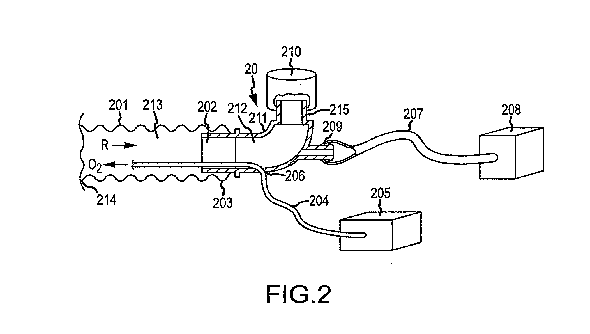 Airway adjunct resuscitation systems and methods