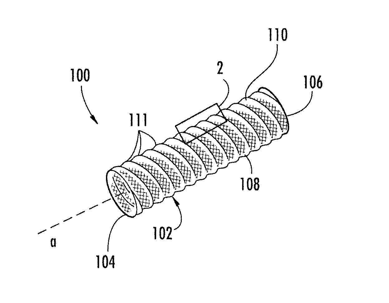 Medical device including corrugated braid and associated method