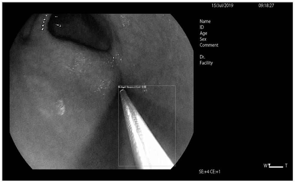 A method and system for automatically identifying biopsy sites and biopsy quantities under endoscopy