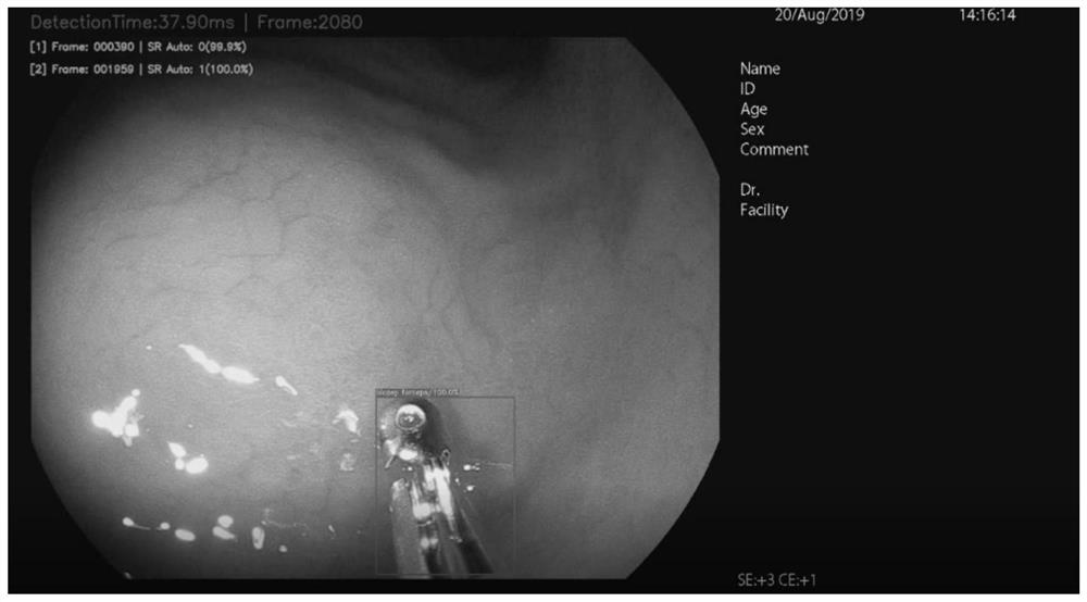 A method and system for automatically identifying biopsy sites and biopsy quantities under endoscopy