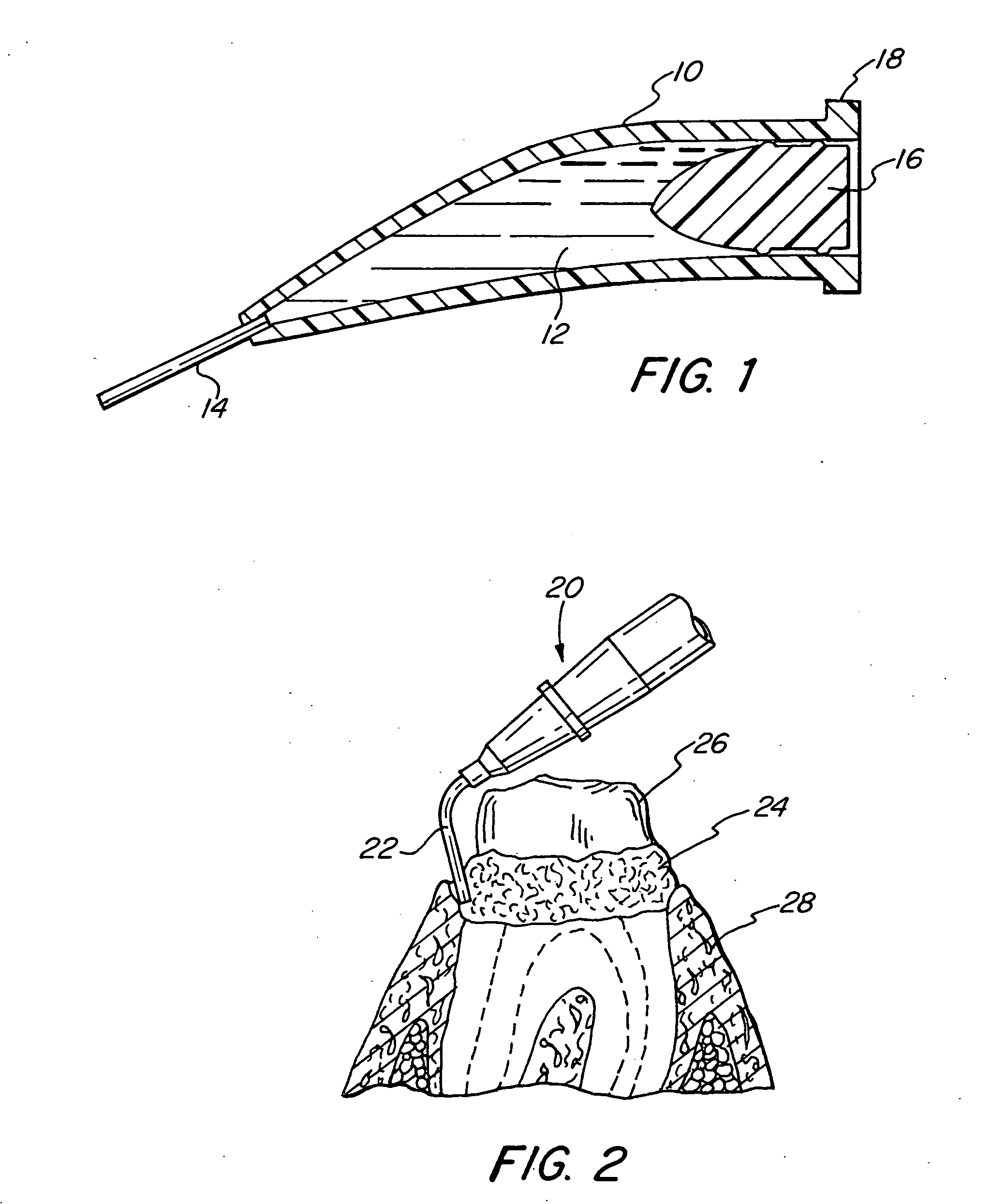 Dental retraction material having enhanced fluid absorption