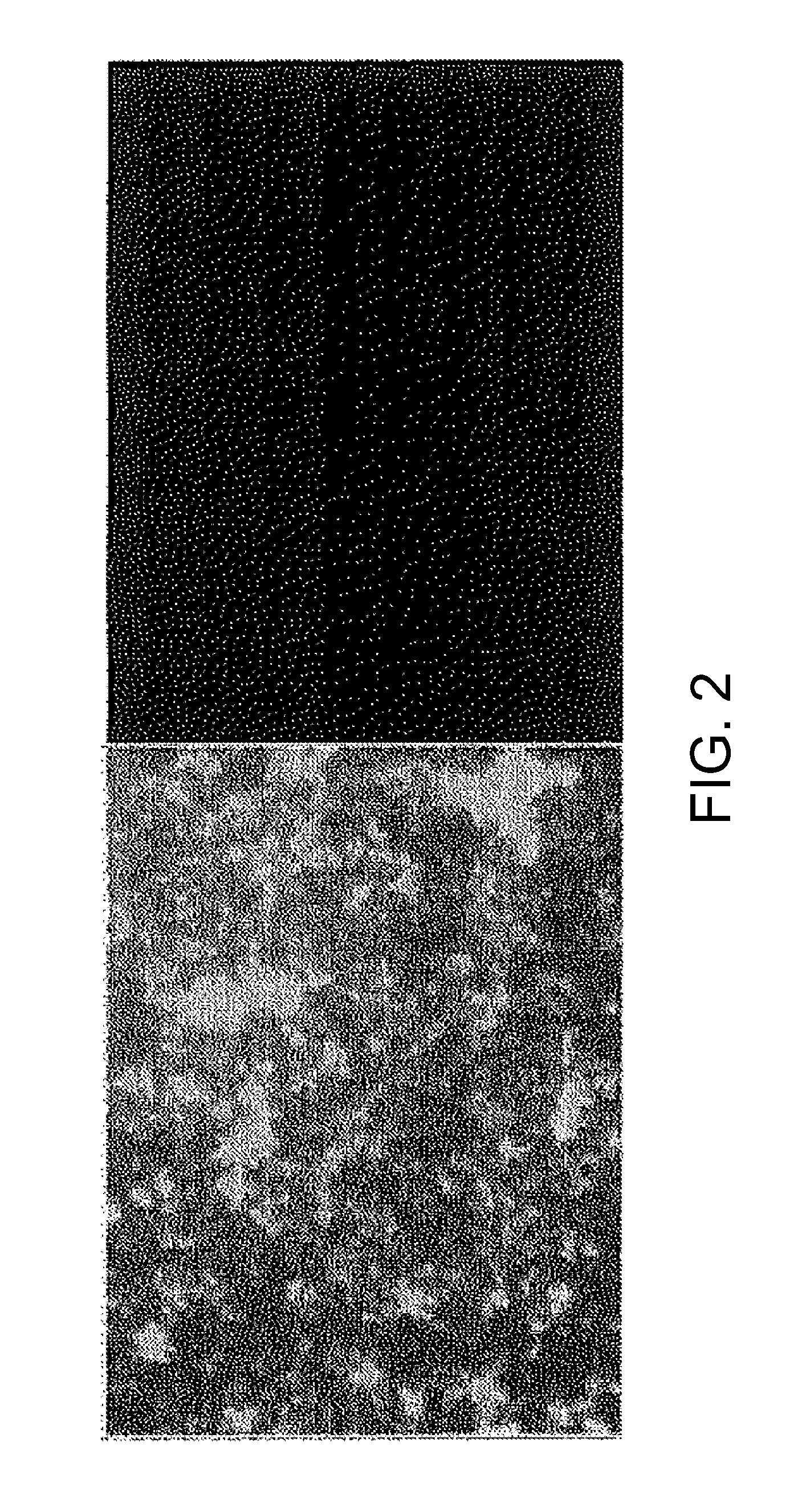 Viral vector nanocapsule for targeting gene therapy and its preparation