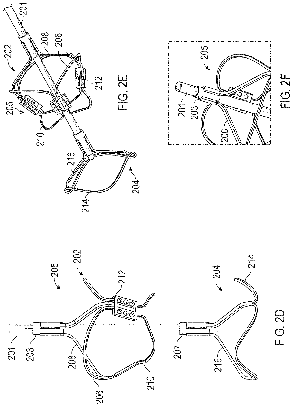 Apparatus and methods for treating a defective cardiac valve