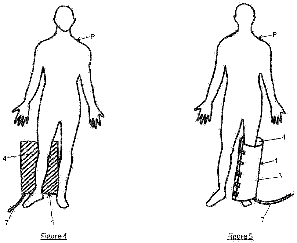 Assembly comprising a suction device suitable for being placed on a wound and/or an incision