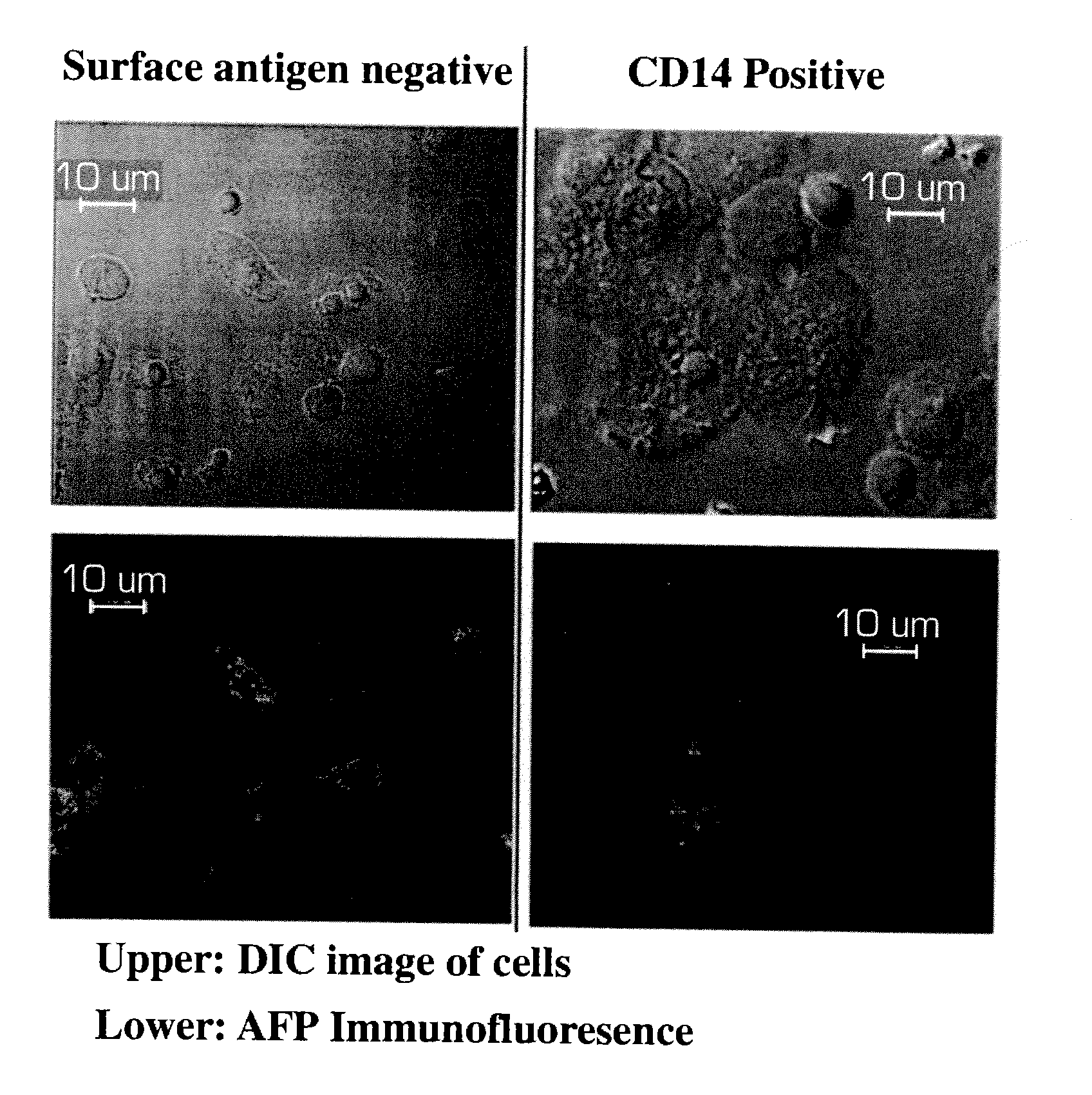 Human liver progenitors