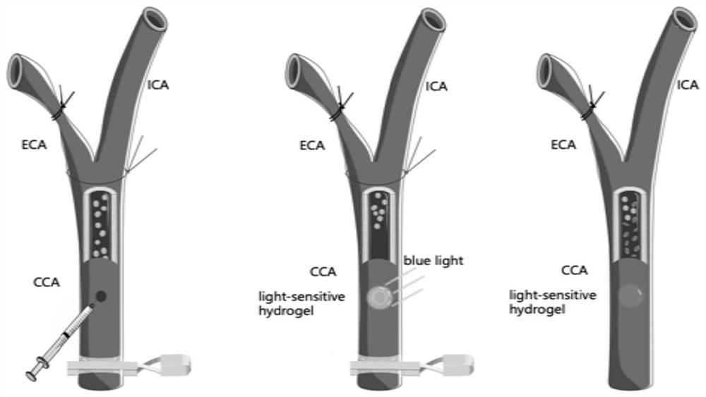 Construction method of novel carotid artery injection brain metastatic tumor animal model