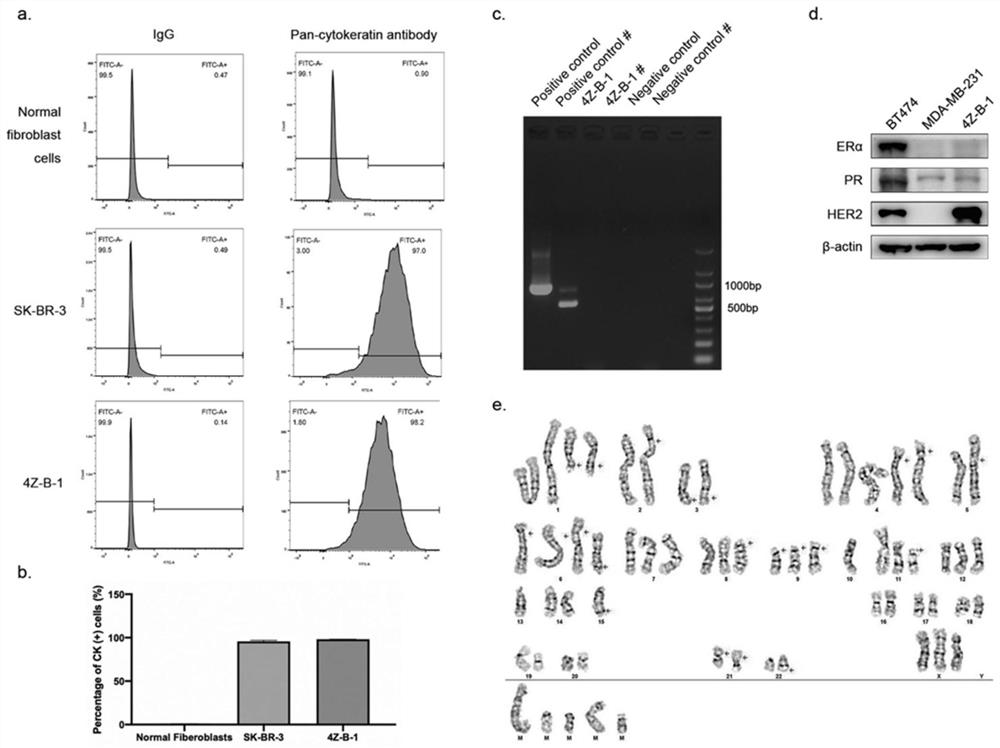 Human breast cancer pleural effusion metastasis cell line and its application