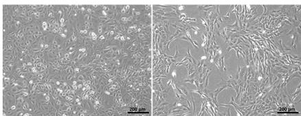 Endothelial cell osteogenesis induced differentiation culture medium and preparation method thereof