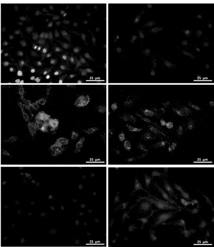 Endothelial cell osteogenesis induced differentiation culture medium and preparation method thereof