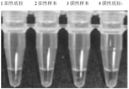 Closed SARS-CoV-2 isothermal amplification nucleic acid detection kit