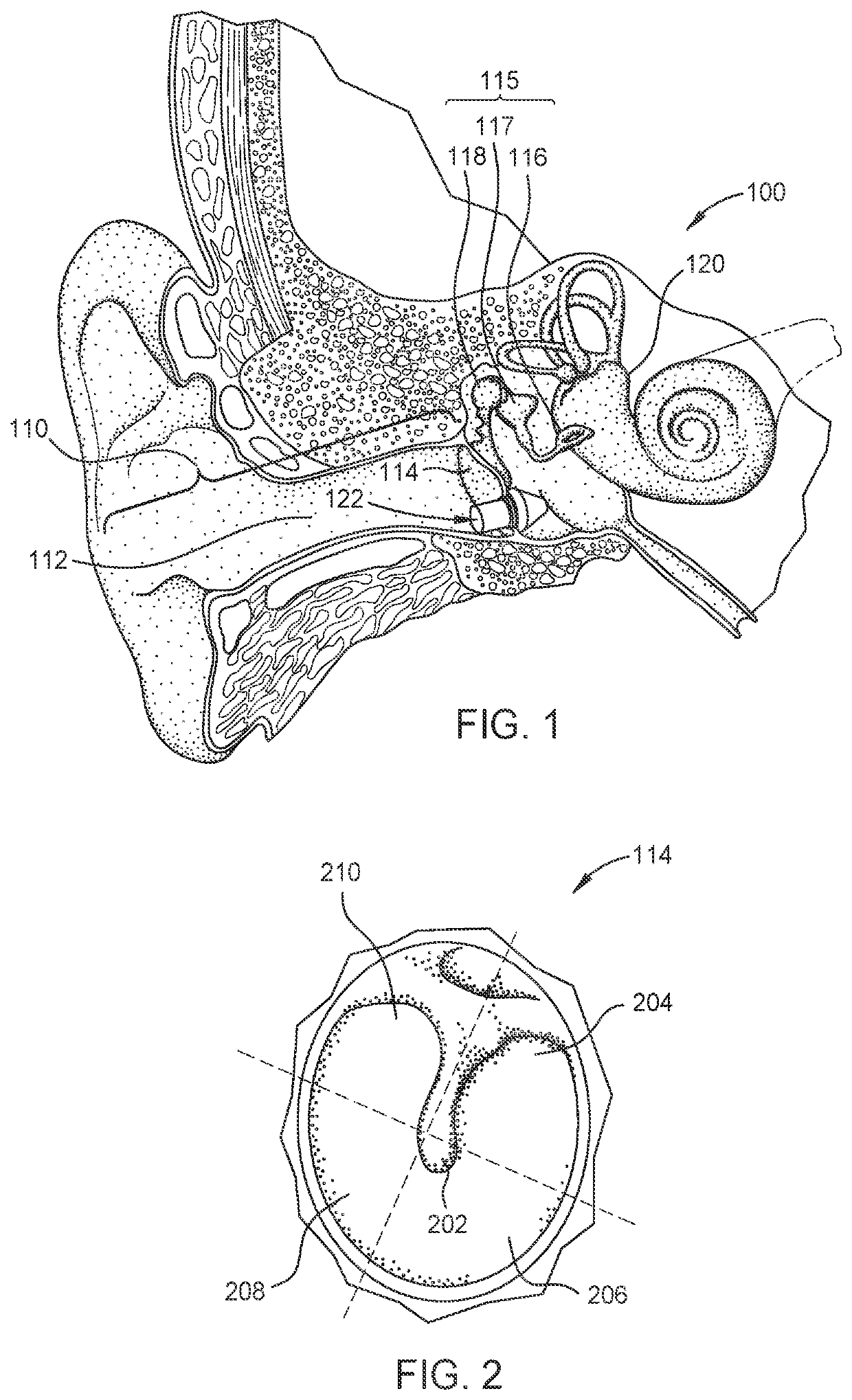 Compact hearing aids