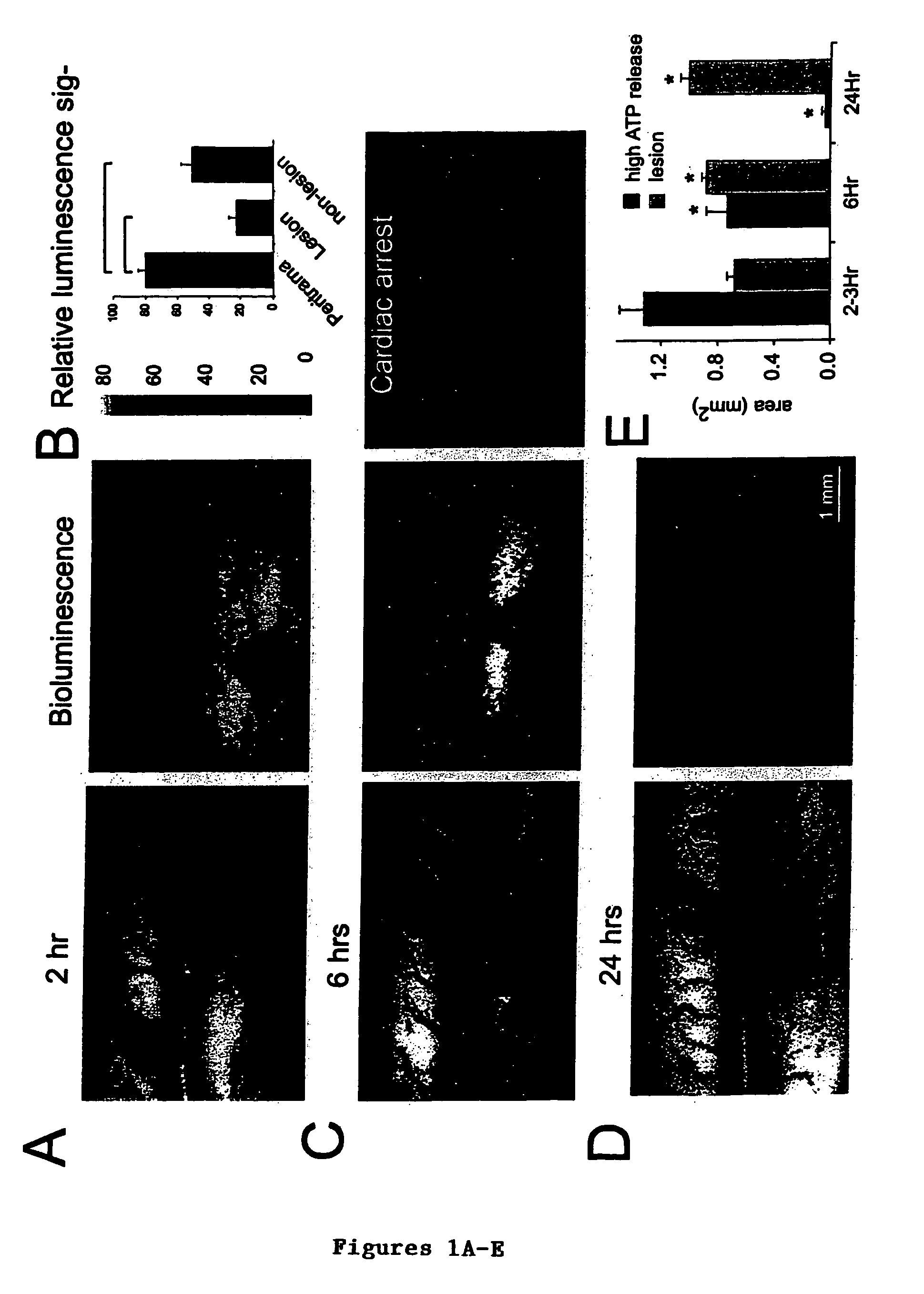 Purine receptor inhibition as a therapeutic strategy in spinal cord and brain