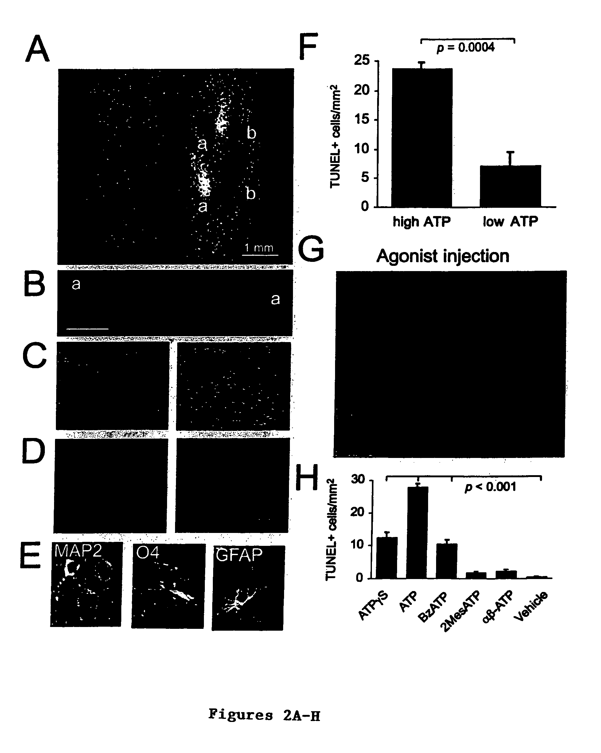 Purine receptor inhibition as a therapeutic strategy in spinal cord and brain