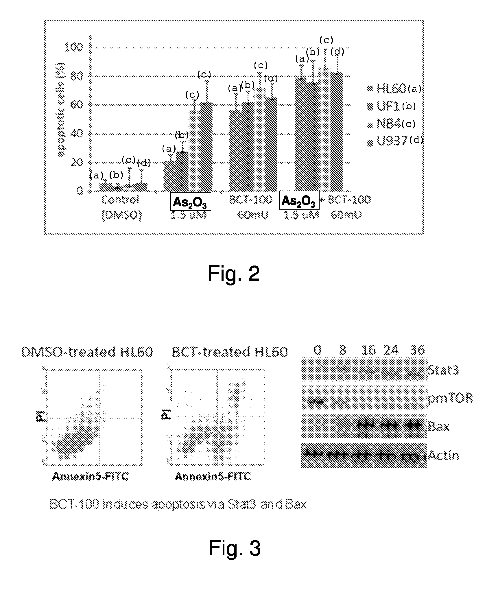 Use of pegylated recombinant human arginase for treatment of leukemia