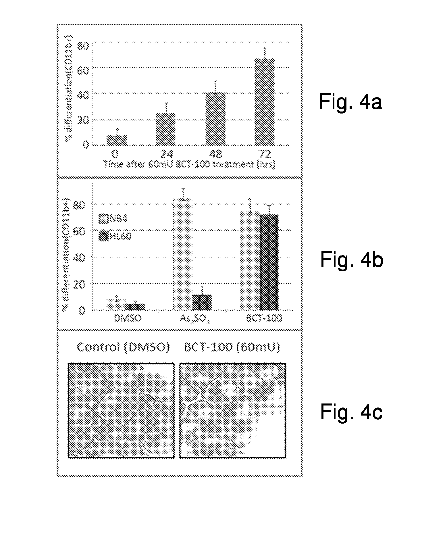 Use of pegylated recombinant human arginase for treatment of leukemia