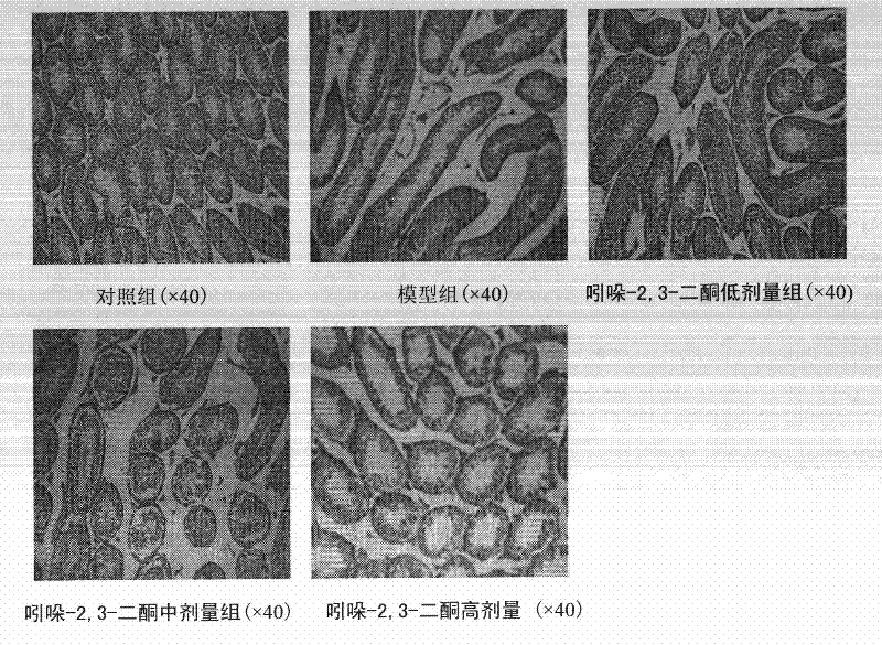 Application of 2,3-didetonindoline in preparation of medicine for improving spermatogenesis dysfunction