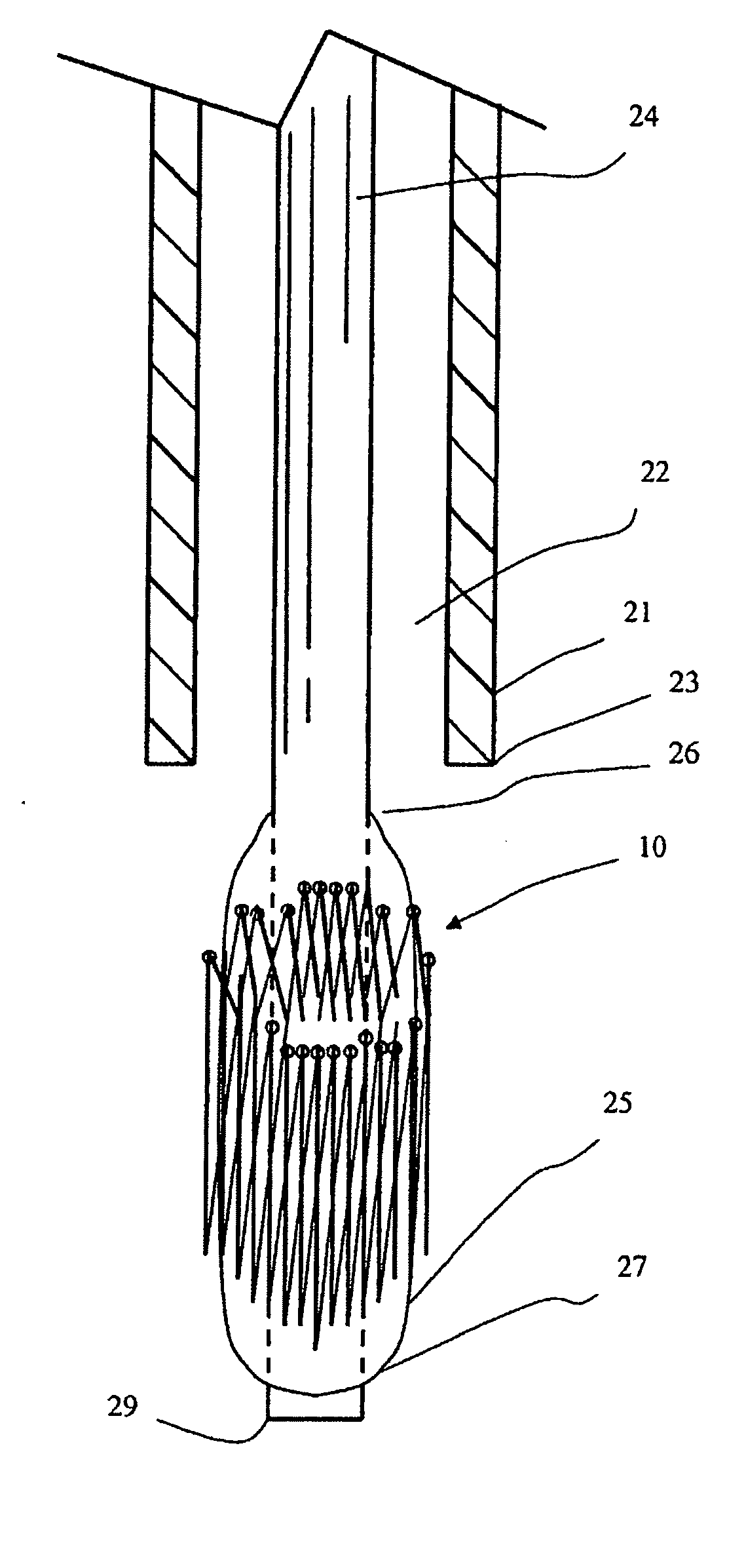 Percutaneously deliverable heart valve