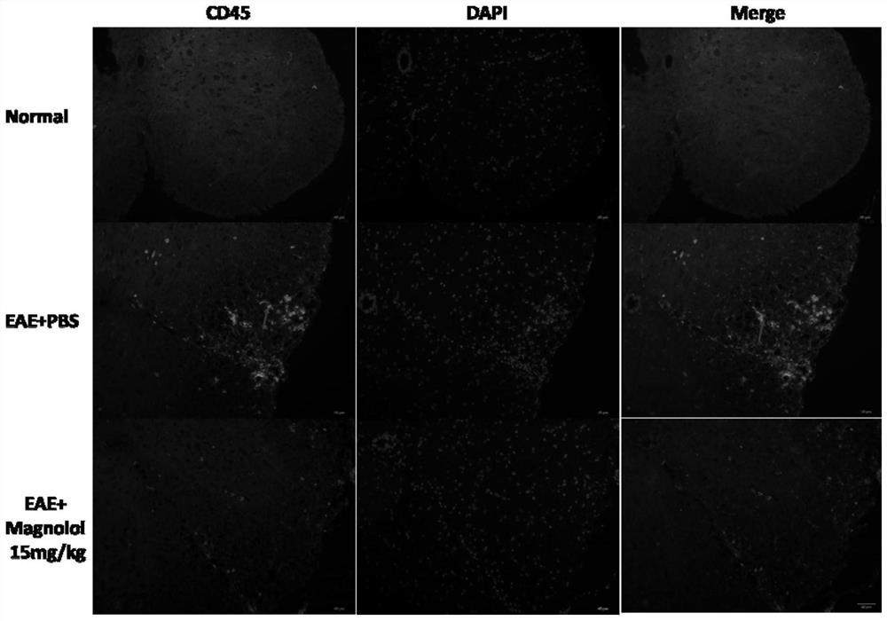 Application of magnolol to preparation of drug for preventing and/or treating myelitis