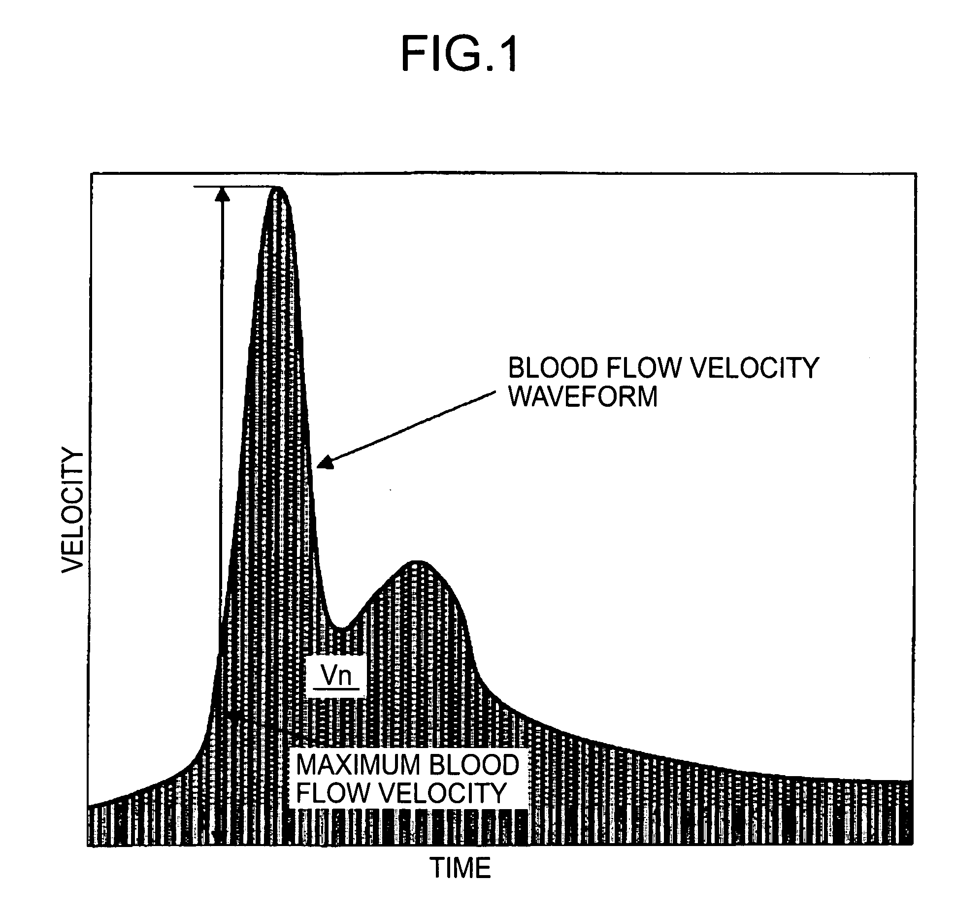 Blood rheology measuring apparatus