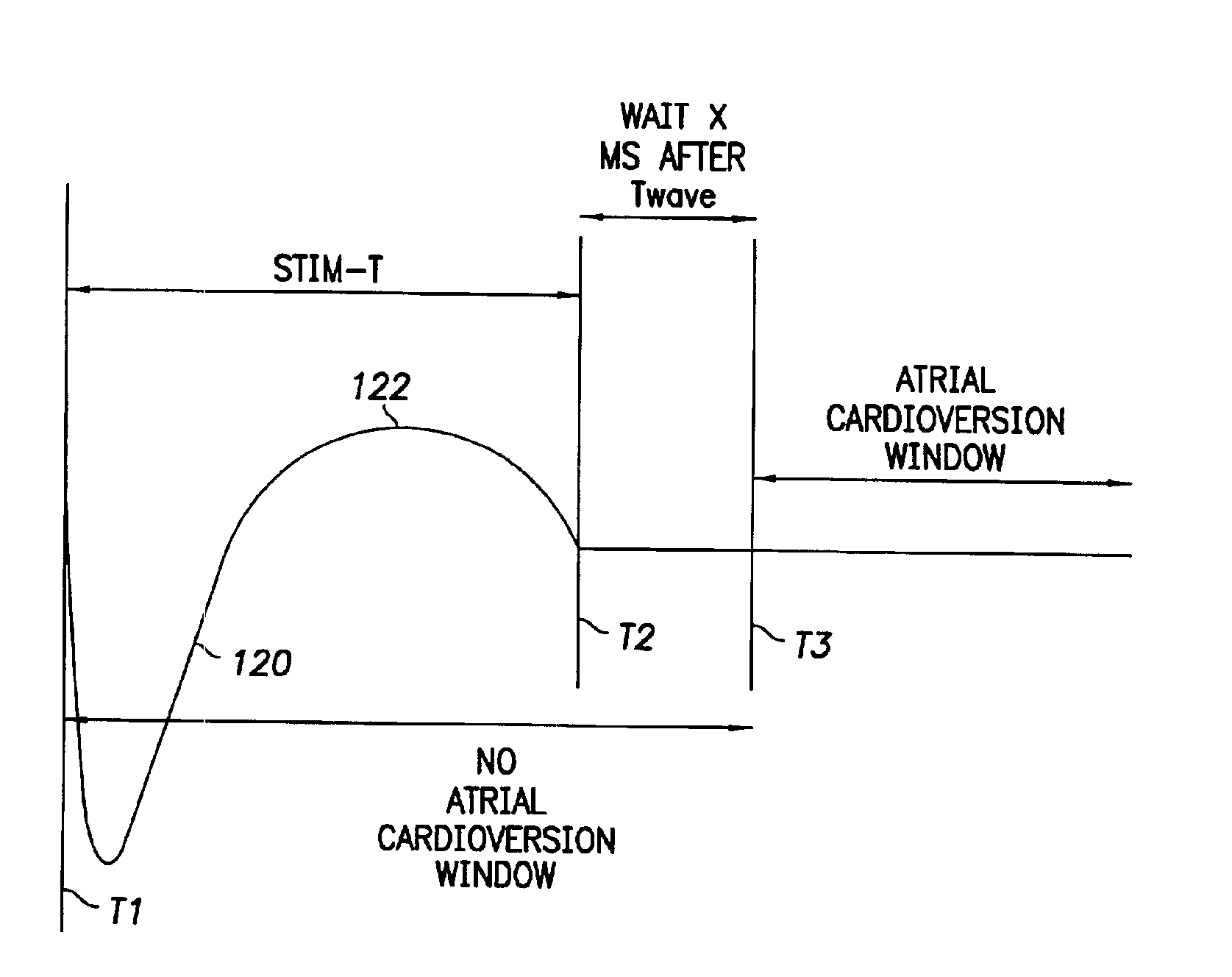 Implantable cardiac stimulation device that defibrillates the atria while avoiding the ventricular vulnerable period and method