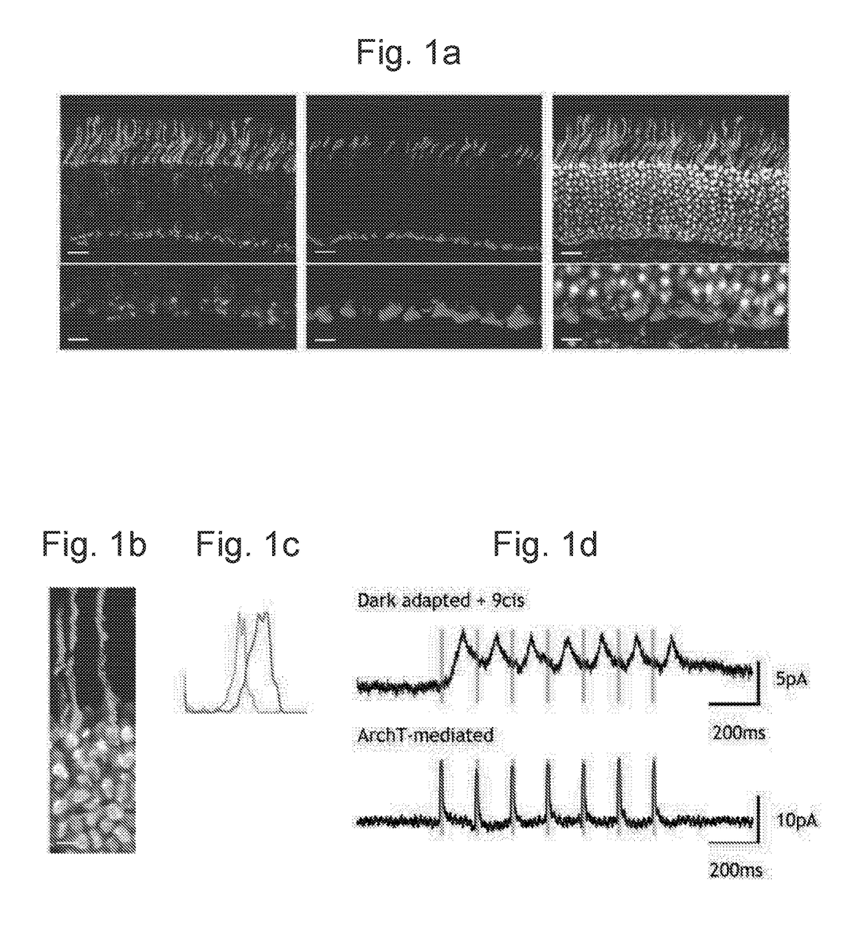 Gene therapy to improve vision