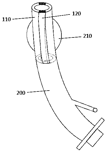 Tracheal catheter with adjustable inner diameter