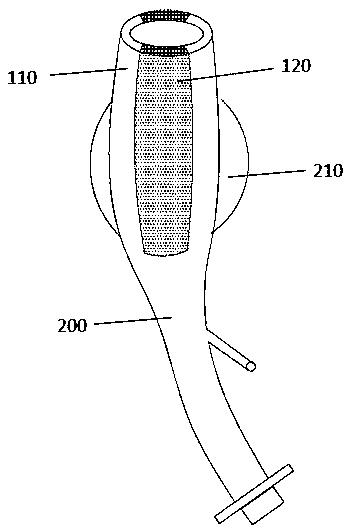 Tracheal catheter with adjustable inner diameter