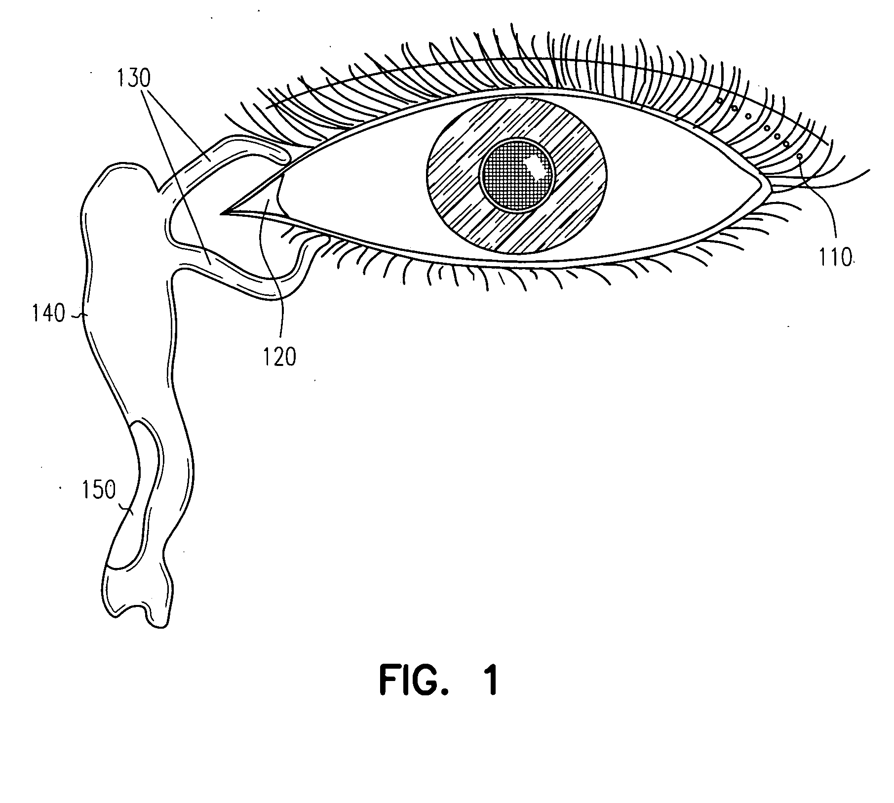 Adhesive bioerodible ocular drug delivery system