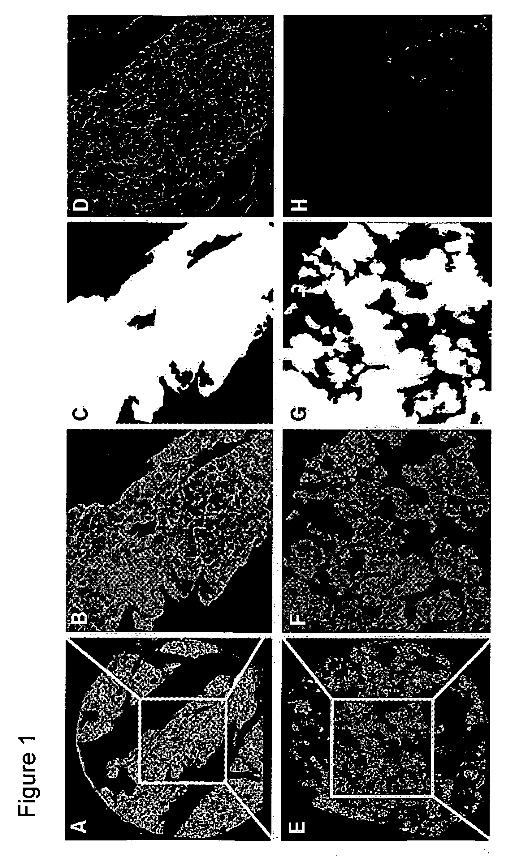 Methods for a predictive diagnostic test for tamoxifen