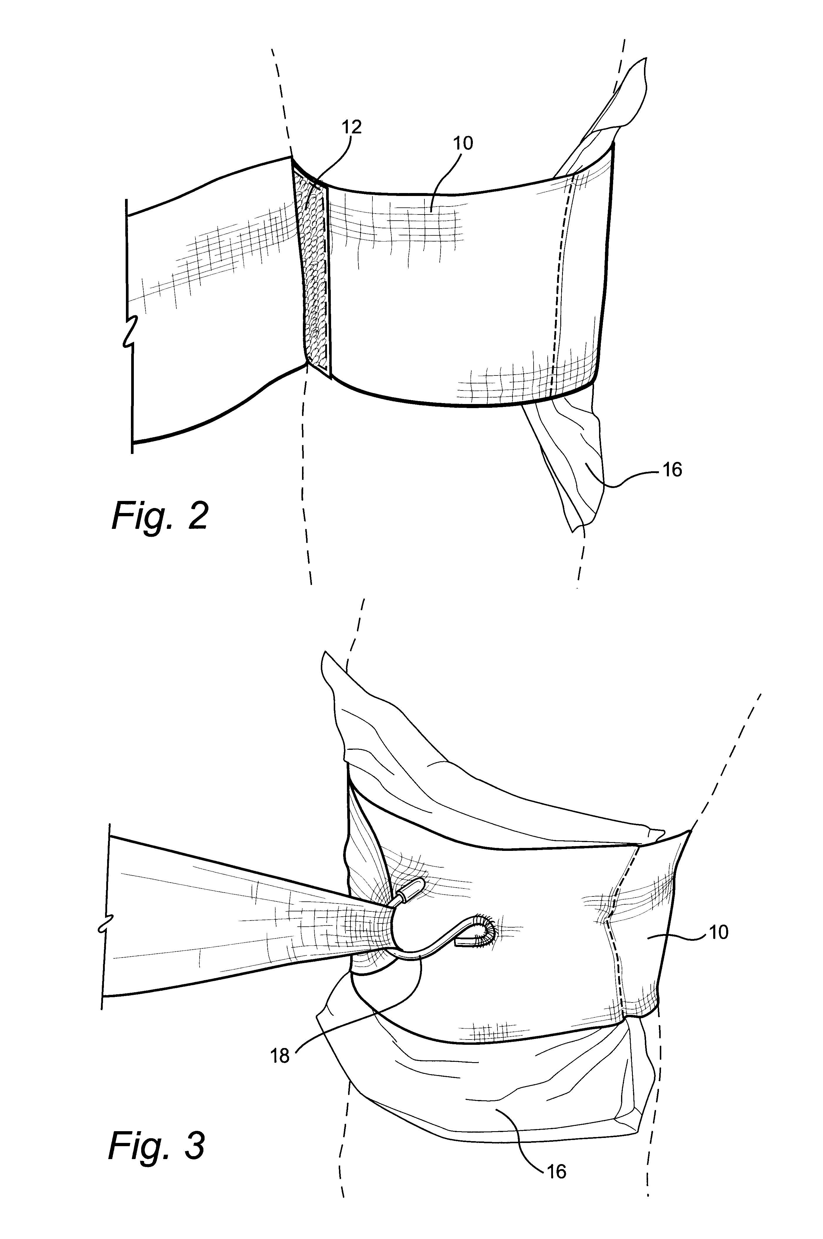 Compression bandage with tightening means