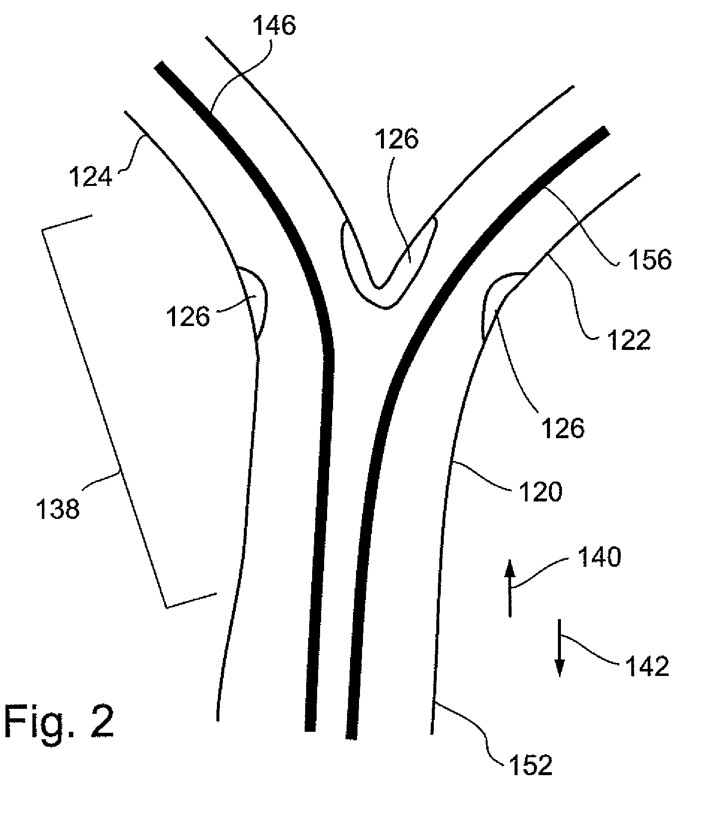 Bifurcated balloon & stent delivery system