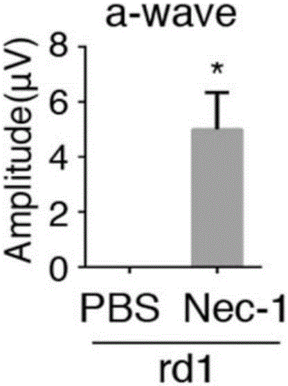 Application of Necrostatin-1 in drugs for treating neurodegenerative eye disease