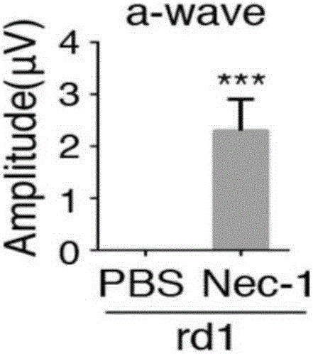 Application of Necrostatin-1 in drugs for treating neurodegenerative eye disease