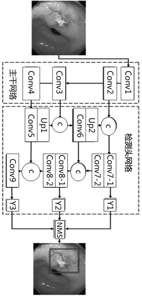 An image recognition method for early gastric cancer based on evolutionary neural network model compression