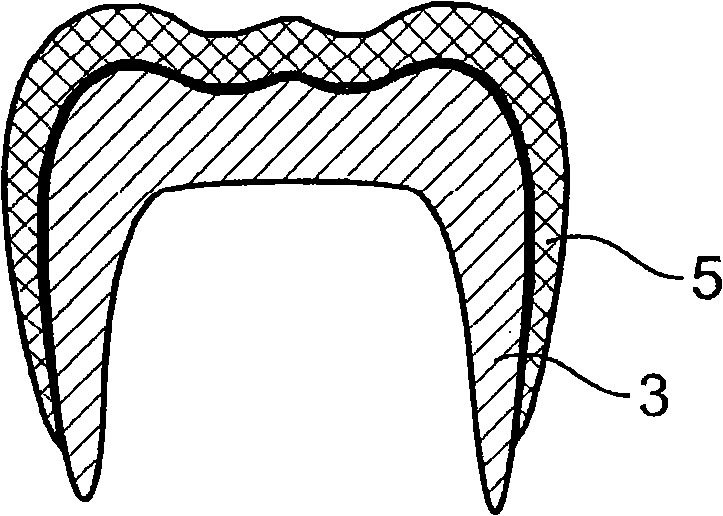 Method and system for producing a dental prosthesis