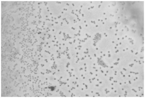 Acinetobacter rhizosphaerae capable of efficiently removing phosphorus and application thereof