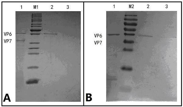 Purification preparation method of human rotavirus inactivated vaccines by utilizing ion exchange chromatography