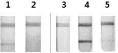 Purification preparation method of human rotavirus inactivated vaccines by utilizing ion exchange chromatography