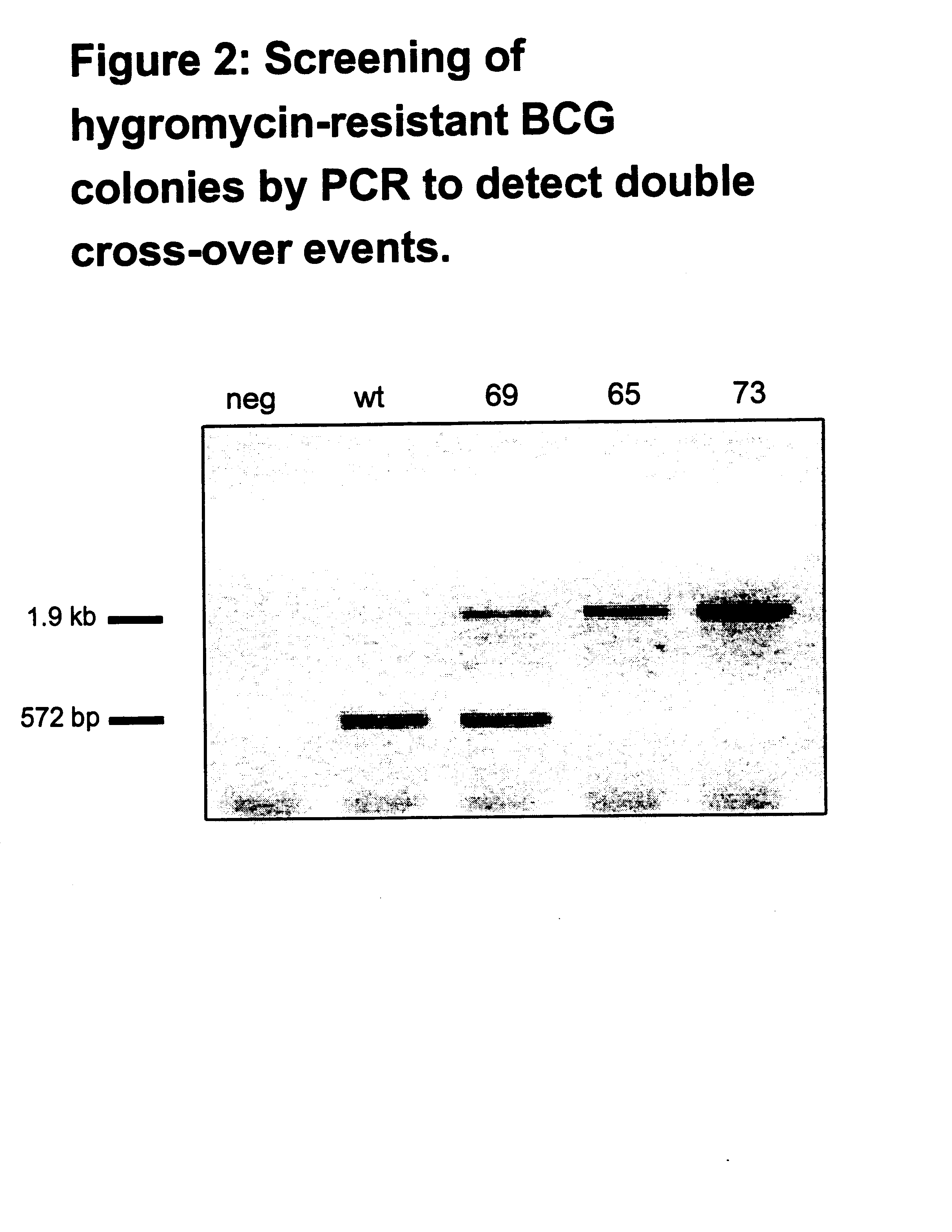 Attenuated strains of mycobacteria