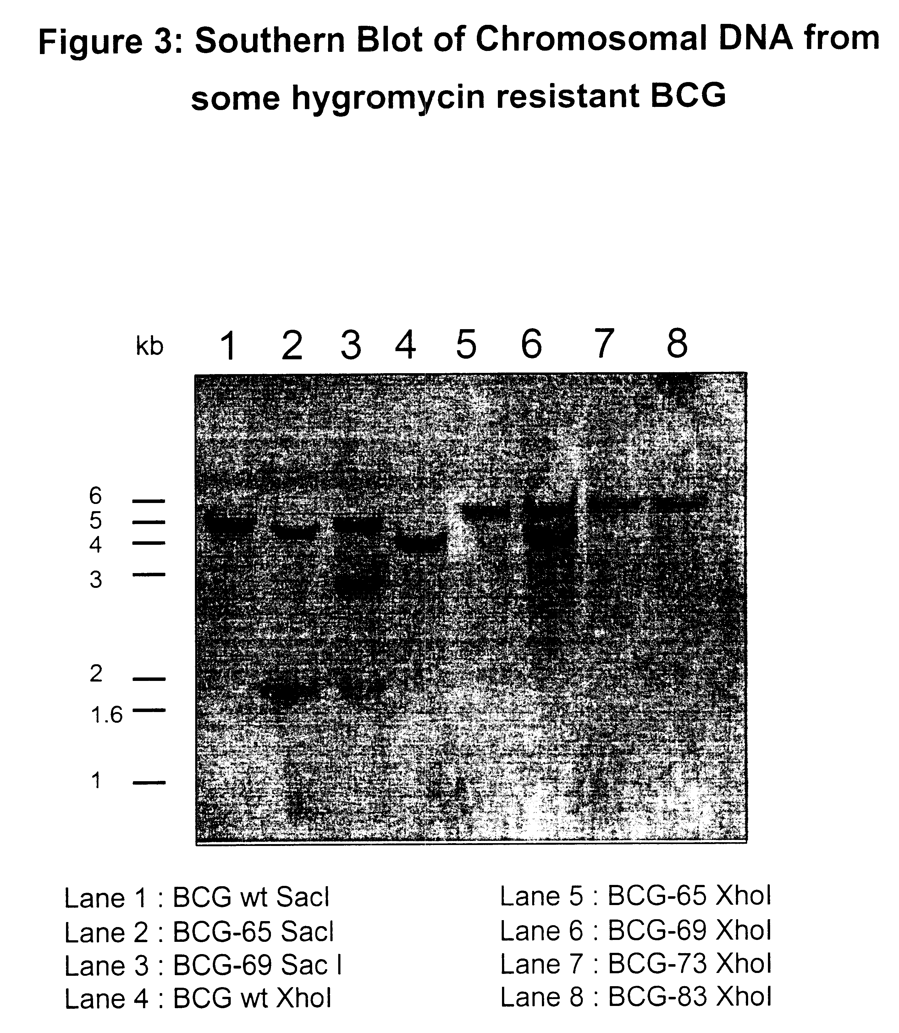 Attenuated strains of mycobacteria