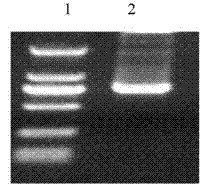 Staphylococcus aureus enterotoxin B (SEB) immune preparation and its preparation method and use