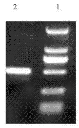 Staphylococcus aureus enterotoxin B (SEB) immune preparation and its preparation method and use