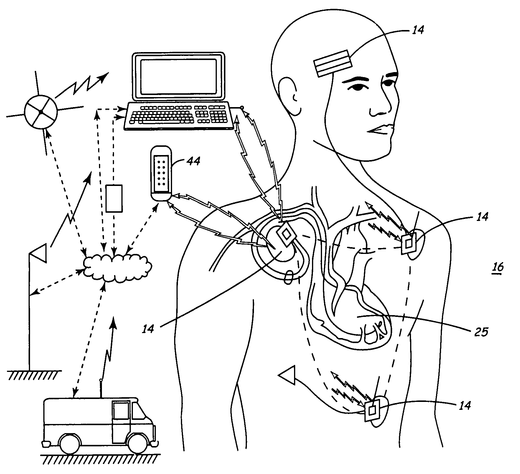 Medical device systems implemented network scheme for remote patient management