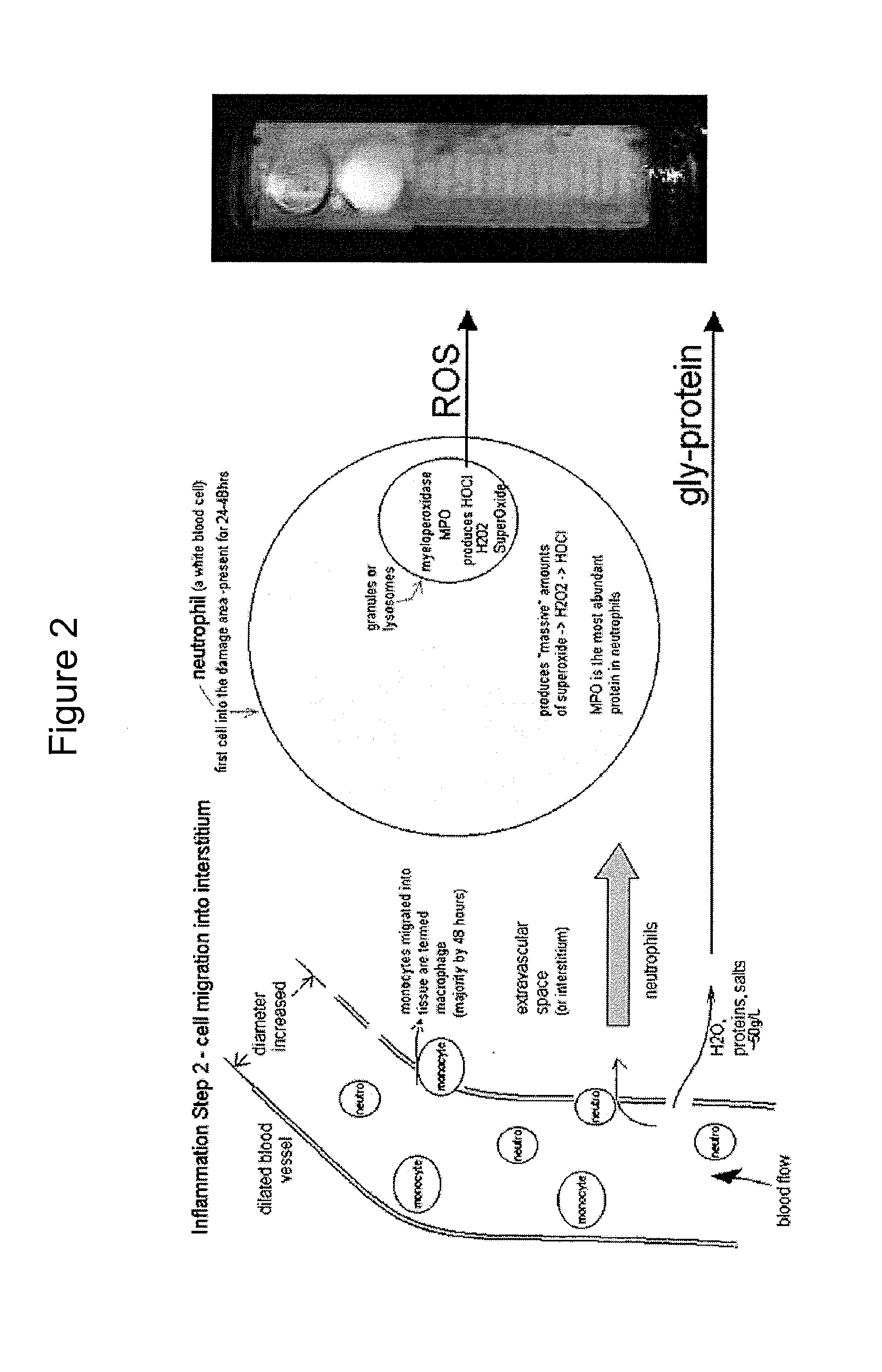 Protective shell for an in vivo sensor made from resorbable polymer